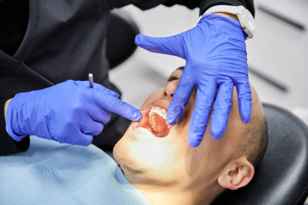 Best Emergency Dental Care for Abscessed Tooth in Frederic, WI
