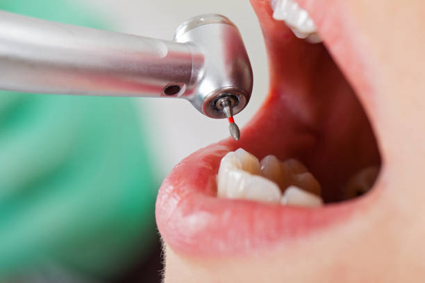 Best Weekend Emergency Dentist in Frederic, WI